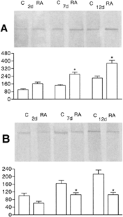 6 Western blot analysis of occludin (A) and phosphotyrosine (B) after immunoprecipitation with anti-ZO-1 in HepG2 cells cultured for 2, 7, and 12 days in the absence (C) or presence of retinoic acid (RA). Densitometric evaluation of the bands, expressed as percentage of control after two days of culture, shows an increase of about 45% after 7 and 12 days of treatment in the amount of ZO-1 bound to occludin (A) and a decrease of about 35% after 7 days and of about 50% after 12 days of RA treatment in the amount of tyrosine-phosphorylated ZO-1 (B). Results are the average of at least four different experiments ±SD. *P < 0.01.