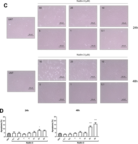 Figure 1 Evaluation of Nutlin-3 effects on ARPE-19 cell line. Cell viability (A) cell cycle (B) and apoptosis (D) evaluation in ARPE-19 cells treated for 24 h or 48 h with different Nutlin-3 concentrations (range 0.1–50 μM). In (C), representative bright-field images of ARPE-19 cells exposed to the above treatments are shown (bar=200 μm). In (A, B and D) results are reported as mean ± S.D. of at least three independent experiments. Statistical analysis was performed by ANOVA followed by Bonferroni post hoc test for pairwise comparisons. *p < 0.1, **p < 0.01, ***p < 0.001, ****p < 0.0001 with respect to untreated cells (UNT).