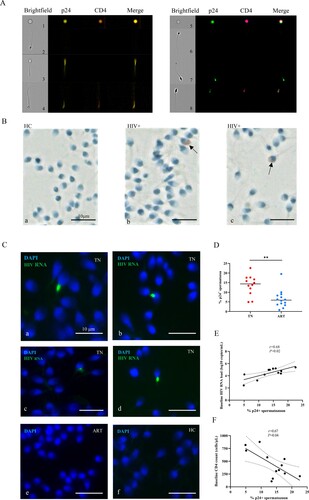 Figure 1. Detection of HIV p24 protein and HIV RNA in spermatozoa. (A) HIV p24 protein detected in semen cells from HIV-infected men by imaging flow cytometry. Left picture (p24-PE, CD4-BV605); right picture (p24-FTC, CD4-APC/Cy7). (B) HIV p24 detected in spermatozoon of HIV-infections in the TN group (b-c, black arrow) and healthy controls (a) via immunohistochemical analysis. The sperm nuclei are stained light blue with hematoxylin, and p24 Ab signal is red. (C) a–d, HIV RNA detected in spermatozoon from treatment-naïve (TN) HIV-infected patients using RNAscope; HIV RNA cannot be detected in spermatozoa from antiretroviral (ART) HIV-infected patients (e) and healthy men (f). Green fluorescence represents HIV RNA, and blue fluorescence represents nucleic acid in the sperm nucleus. (D) HIV p24-positive rates of spermatozoon in the TN and anti-retroviral therapy (ART) groups. (E–F) Linear regression between the ratio of p24+ spermatozoa and baseline plasma HIV RNA and baseline CD4+ T cell count. HIV p24-positive rates of spermatozoa were calculated from imaging flow cytometry cell counting. The Mann–Whitney U nonparametric test was used to compare the two groups. *P < 0.05. r, Pearson correlation coefficient. P < 0.05 is considered significant. The dotted line represents the 95% confidence interval.