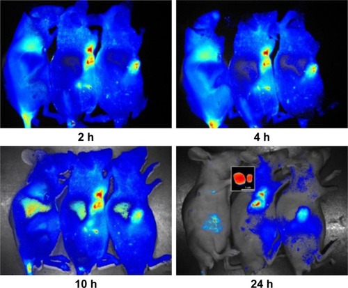 Figure 4 The real-time imaging observation after intravenous administration of varying DiR formulations.