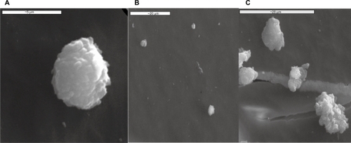 Figure 8 SEM images of: A) a human platelet onto carbon substrate, B) inactivated platelets on type B carbon nanocoating with 5% H2 in plasma during deposition, after one hour of incubation and C) activated platelets on to type A carbon nanocoating with 5% H2 in plasma during deposition, after 1 hour of incubation.