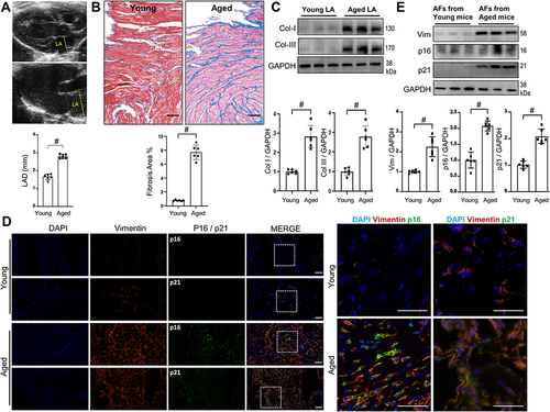 Figure 1 Age-related LA fibrosis in mice. Both young (6~8 weeks) and aged (24 months old) mice were received echocardiography examinations, followed by harvesting of LA tissues for Masson trichrome, WB, immunofluorescence staining or isolation of AFs. (A) Representative echocardiographic images of LA dimension and their quantitative analyses. n=6. (B) Representative images of Masson trichrome staining of LA sections and their quantitative analyses. n=6. bar=50μm. (C) Representative WB images and their densitometry analyses of collagen-I and collagen-III protein expressions in LA tissues. (D) Representative immunofluorescence images of LA sections stained with DAPI, vimentin, p16 and p21 as indicated. bar=50μm. (E) Representative WB images and their densitometry analyses of vimentin, p16 and p21 protein expressions in isolated pure AFs. n=6. Data are presented as mean ± SD. #p<0.001.