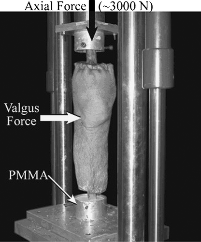 Figure 2. Fracture simulation set-up: Axial loading was applied to the extended knee on an MTS (Bionix 858 materials testing machine). Upon joint closure, confirmed by fluoroscopy, a lateral impact was applied to the specimen to create the tibial plateau fracture.