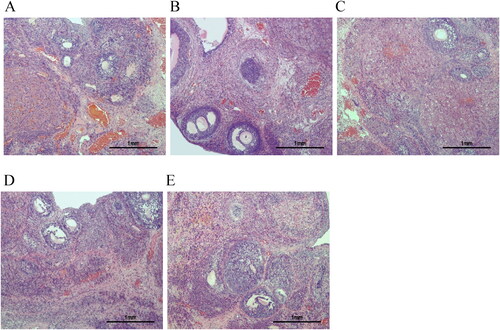 Figure 2. HE staining was used to evaluate the histological morphology of ovarian tissues (magnification ×100). A: Control group (n = 3). B: PCOS group (n = 3). C: CDD group (n = 3). D: Metformin group (n = 3). E: IWR group (n = 3). Scale bar: 1mm.