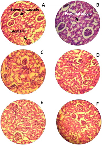 Figure 3. H&E staining of rat kidney. (A) Untreated rat for 14th day (−); (B) Untreated rat for 28th day, normal kidney tissues glomerular cells, bowman capsule (−); (C) Rats treated with Bio-AgNPs, i/p route for 14th day (−); (D) Rats treated with Bio-AgNPs, i/p route for 28th day (+); (E) Rats treated with Bio-AgNPs, i/v route for 14th day (+); (F) Rats treated with Bio-AgNPs, i/v route for 28th day (−). *where (−) indicates no changes, (+) indicates mild changes, (++) indicates moderate changes, (+++) indicates severe changes.