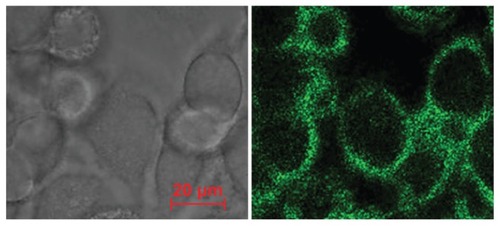 Figure 4 Cell targeting and positioning of the brucine immuno-nanoparticles. Complete uptake and even distribution of the brucine immuno-nanoparticles around the liver cancer cell membrane after incubation for 4 hours (A) ring green fluorescence; (B) without laser excitation; 400× magnification.