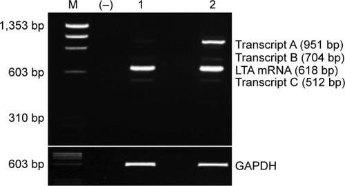 Figure 1 RT-PCR products of LTA mRNA detected by 3% agarose gel electrophoresis stained by ethidium bromide.