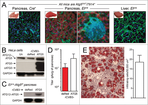Figure 6. rCVB3-encoded ATG5 restores the functional deficiency in ElCre-Atg5f/f acinar cells, and enhances viral replication and pathogenesis. (A) The extent, and cell-specificity, of ELCre activity was determined by confocal microscopy of vibratome sections from the F1 cross of ElCre-Atg5f/f mice against JAX 7914 mice (which carry a reporter cassette that, when cleaved by Cre recombinase, causes expression of the Tomato fluorescent protein). Genotyping showed that, as expected, all mice in the resulting litter were Atg5f/WT-7914+; and ∼50% also carried ElCre. Pancreatic samples were taken from mice expressing ELCre (2 central images, the rightmost of which shows a higher magnification including an islet of Langerhans). Negative controls were (i) pancreatic tissue from a mouse lacking ElCre (left image) and (ii) liver from an ELCre-expressing mouse. Red = Tomato; Blue = nuclei (Hoechst 33342 dye); Green = F-actin (phalloidin staining; phalloidin binds to F-actin, thereby revealing the cytoskeleton). Images are representative, and are from 2 independent experiments (n = 4 mice per group). Twenty-six pancreatic fields were evaluated for ElCre mice, and 2 fields for the Cre-negative control mice. (B) HeLa cells were infected with Atg5-CVB3 or with dsRed-CVB3, and a western blot was probed for ATG5, or for GAPDH. (C) ElCre-Atg5f/f mice were infected with Atg5-CVB3 or with dsRed-CVB3 and, 2 d later, their pancreata were harvested, and the amount of ATG12-ATG5 complex was determined by western blot. The complex is absent from the pancreata of mice infected with dsRed-CVB3, but is abundant in the pancreata of Atg5-CVB3-infected animals, demonstrating that the virus-encoded ATG5 is biologically active. (D). Virus titers show that the provision of ATG5 by rCVB3 increases viral replication in the pancreata of ElCre-Atg5f/f mice. (E). This increased replication is reflected by marked pancreatitis (Masson trichrome stain; n = 7 mice, in 5 independent experiments; quantitation shown in bar graph).