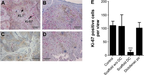Figure 5 Immunohistochemistry of recurrent tumor tissues double stained for cytokeratin (KL1, brown) and the proliferation marker Ki-67 (red) for the following groups.Notes: (A) Untreated. (B) Scaffold without diclofenac. (C) Scaffold-loaded diclofenac. (D) Diclofenac po. (E) A significantly reduced number of cells in the tumor region expresses the proliferation marker Ki-67 in recurrent tumors derived from mice with scaffold-loaded diclofenac. ***P<0.001. The scale bars represent 200 μm. Magnifcation is ×20.Abbreviation: DC, diclofenac.