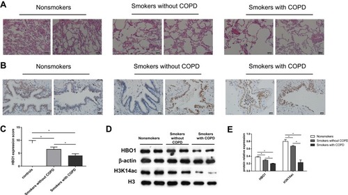 Figure 1 HBO1 expression in peripheral lung tissue. (A) HE staining of peripheral lung tissue. (B) IHC staining of HBO1 in peripheral lung tissue. (C) The mean IOD of HBO1 in the airway epithelium. (D and E) The levels of total HBO1 and H3K14ac protein in specimens were measured by Western blot. P-values were calculated by analysis of variance (ANOVA). *P<0.05.