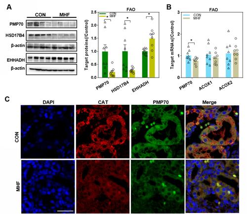 Figure 3 Effects of maternal high-fat on fatty acid β-oxidation (FAO) regulators in the fetal kidney. (A) Western blot analysis of FAO regulators. (B) The qPCR analysis of the mRNA levels of FAO regulators. (n =8 per group, *p < 0.05 vs control). (C) IF staining of Peroxisomal membrane protein (PMP) 70 and catalase (CAT) co-localization in the fetal kidney (magnification of 800×; scale bar = 50μm).