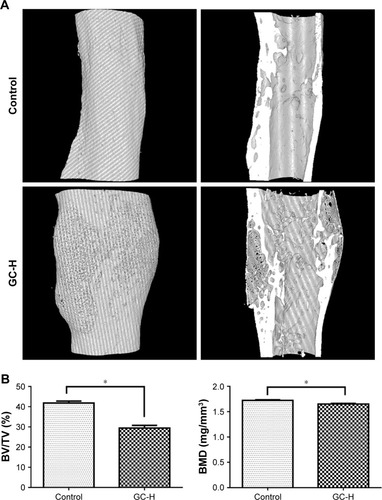 Figure 5 Micro-CT analysis of fractured femoral callus from representative specimens at 9 weeks post-fracture.