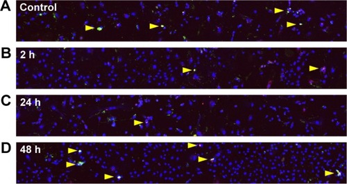 Figure 4 Apoptosis in HUVECs detected by immunofluorescence using Annexin V-FITC Apoptosis Detection Kit.Notes: Untreated control cells (A) and cells exposed to QDs for (B) 2 h, (C) 24 h and (D) 48 h show sporadic apoptosis (yellow arrows). Observation area =3,399×425 µm2. Red = PI (late apoptosis), green = Annexin V-FITC (apoptosis onset) and blue = Hoechst (nuclei).Abbreviations: HUVEC, human umbilical vein endothelial cell; QD, quantum dot; PI, propidium iodide.