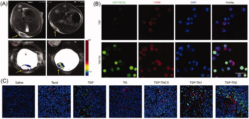 Figure 4. TNO3 and TPGS-S-S-PTX hybrid micelles. (A) In vivo tumor vascular permeability and blood perfusion presented by Representative MRI images in an S180 tumor model. (B) CLSM images for of micelle uptake and NO release in MCF-7/ADR cells. NO was detected by DAF-FM DA (green). Micelles were labeled by with RhB (red), and nuclei were stained by with DAPI (blue). Scale bar, 50 μm. (C) Representative immunofluorescentce images of blood vessels and tumor apoptosis of in MCF-7/ADR tumors. Blood vessels, nuclei and apoptotic cells were stained by α-CD31 antibody (red), DAPI (blue) and TUNEL (green), respectively (Yin et al., Citation2017b) (colour figure online).