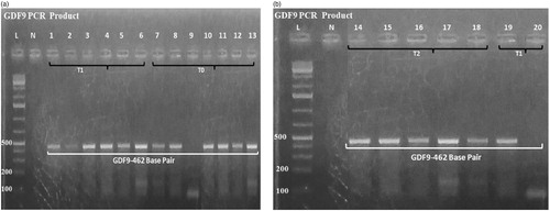 Figure 2. (a) PCR products of GDF9 gene 462 bp amplicon sizes; (b) PCR products of GDF9 gene 462 bp amplicon sizes.