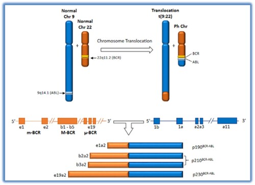 Figure 2. Pictorial representation of translocation (9; 22) and the resultant BCR – ABL transcripts associated with CML, AML and ALL [Citation19].