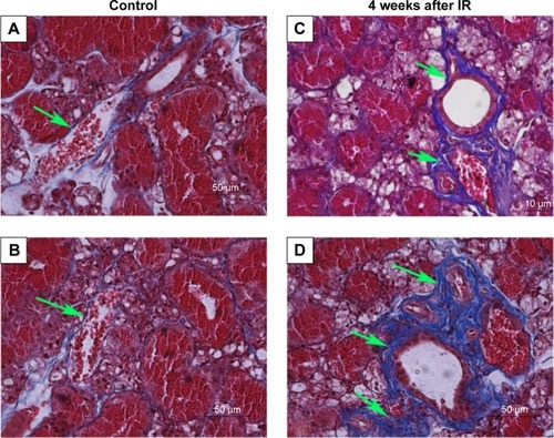 Figure 4 Masson’s trichrome staining; collagen stained blue.