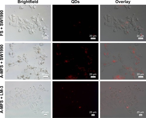 Figure 4 In vitro targeting test.Note: The red fluorescent dots were found more frequently on the surface of SW1990 cells, after incubation with A-MFS.Abbreviations: A-MFS, Fe3O4@SiO2 modified with anti-mesothelin antibody; QD, quantum dot.