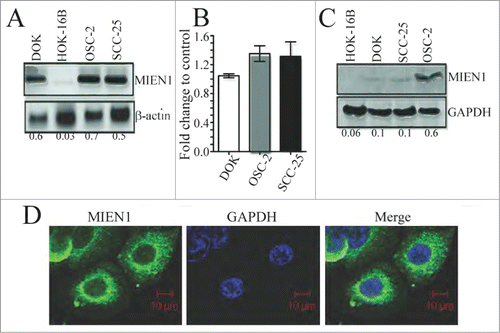 Figure 1. MIEN1 is differentially expressed in oral cancer cells. (A) MIEN1 expression in different oral cancer cells as shown by qualitative PCR. (B) Graphical representation of MIEN1 mRNA expression in dysplastic and carcinoma cells, normalized to GAPDH, from qPCR experiments. (C) MIEN1 protein expression normalized to GAPDH as shown by protein gel blotting. (D) Immunofluorescence staining of OSC-2 cells showing MIEN1 localization. Representative image as captured using confocal microscopy.