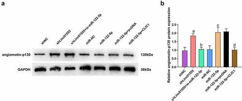 Figure 7. Restraining linc01555 upregulates Amot-p130 via miR-122-5p/clic1 axis. (a, b) Western Blot to detect Amot-p130 in each group of cells. A P <0.05, vs. The shNC; b P <0.05, vs. The shLinc01555; c P <0.05, vs. The miR-NC; d P <0.05, vs. The miR-122-5p + pcDNA.