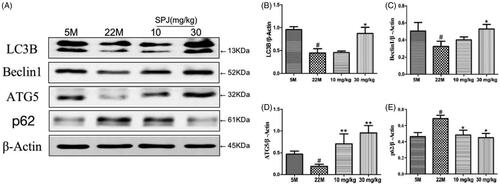 Figure 4. Effect of SPJ on autophagy-related protein levels in the hippocampus of ageing rats. (A) Representative immunoblot bands of LC3, Beclin1, ATG5 and p62 levels in hippocampus. (B–E) Quantification of LC3, Beclin1, ATG5 and p62 after normalisation to β-actin. #p < 0.05 vs. 5 M group; *p < 0.05 or **p < 0.01 vs. 22 M group.