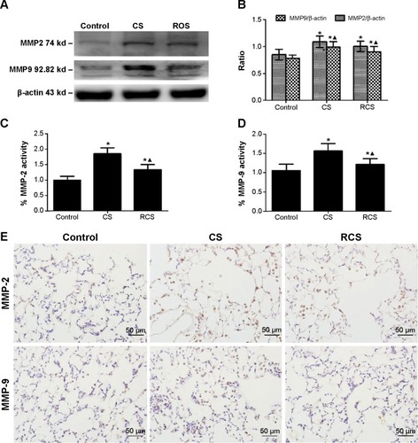 Figure 3 Effects of rosiglitazone on the expression of MMP2 and MMP9 in Cs-induced emphysema in rats.