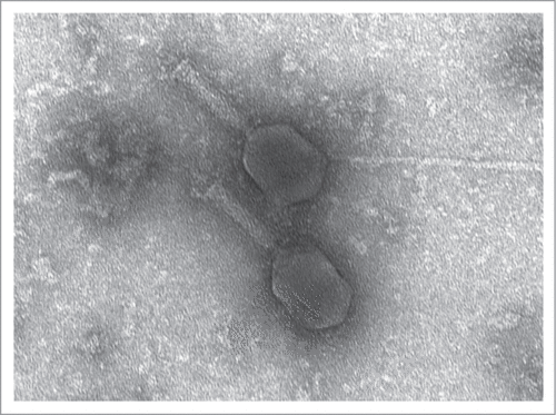 Figure 4. Electron micrograph of the coliphage V18 (magnification × 80,000).