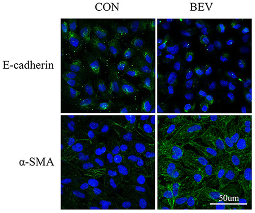 Figure 2 Expression of EMT markers in ARPE-19 cells. The figure shows the changes in the expression levels of E-cadherin and α-SMA in the Ctrl group and the BEV group. It can be seen that there are significant differences in green fluorescent staining between the two groups.