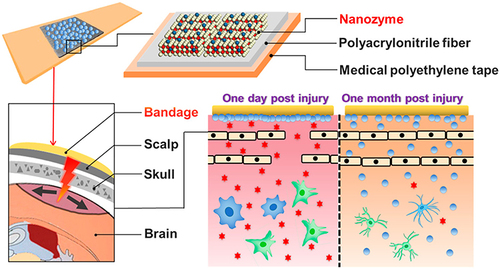 Figure 2 Schematic diagram of the nanozyme-based bandage to treat brain trauma. Reprinted with permission from Yan R, Sun S, Yang J et al. Nanozyme-based bandage with single-atom catalysis for brain trauma. ACS nano. 2019;13(10):11,552–11,560. Copyright (2019) American Chemical Society.Citation108