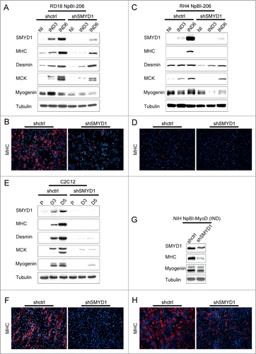 Figure 4. SMYD1 is essential to implement the myogenic differentiation program. (A) Western blot analysis of the indicated proteins in RD18 NpBI-206 cells infected with a constitutive control (shctrl) or SMYD1-directed (shSMYD1) shRNA, treated or not with doxycycline for the indicated days (miR-206 not induced, NI; miR-206 induced, IND). (B) Representative MHC immunostaining of the cells indicated in (A), treated with doxycycline for 6 days (miR-206 induced). Images were obtained at 10X magnification. (C) Western blot analysis of the indicated proteins in RH4 NpBI-206 cells infected with a constitutive control (shctrl) or SMYD1-directed (shSMYD1) shRNA, treated or not with doxycycline for the indicated days (miR-206 not induced, NI; miR-206 induced, IND). (D) Representative MHC immunostaining of the cells indicated in (C), treated with doxycycline for 6 days (miR-206 induced). Images were obtained at 10X magnification. (E) Western blot analysis of the indicated proteins in C2C12 cells infected with a constitutive control (shctrl) or SMYD1-directed (shSMYD1) shRNA, grown in proliferation medium (P) and after 3 or 5 days in differentiation medium (D3, D5). (F) Representative MHC immunostaining of C2C12 cells indicated in (E) after 5 days in differentiation medium. Images were obtained at 10X magnification. (G) Western blot analysis of the indicated proteins in NIH NpBI-MyoD cells infected with a constitutive control (shctrl) or SMYD1-directed (shSMYD1) shRNA, treated with doxycycline for 2 days (MyoD induced, IND). (H) Representative MHC immunostaining of the NIH NpBI-MyoD cells indicated in (G). Images were obtained at 10X magnification.