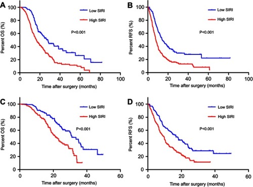 Figure 1 Prognostic significance of SIRI in PDAC patients undergoing radical surgery. Kaplan‒Meier survival curves of OS and RFS stratified by SIRI in the training cohort (A, B) and validation cohort (C, D).Abbreviations: SIRI, systemic inflammation response index; PDAC, pancreatic ductal adenocarcinoma; OS, overall survival; RFS, recurrence-free survival.