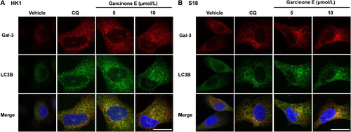 Figure 10. Effect of garcinone E on autophagosome-lysosome fusion in HK1 and S18 cells by immunofluorescence assay. (A, B) Immunofluorescence analysis of LC3B antibody (green) and galectin-3 (red) in HK1 and S18 cells treated with garcinone E (5 and 10 μmol/L) or chloroquine (CQ) (10 μmol/L) for 48 h. Images were taken with a confocal microscope. Scale bar: 20 μm.