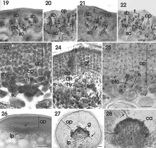 Figs 19–28. Gracilaria corallicola. Female reproductive structures and post-fertilization stages. Fig. 19. Supporting cell bearing a conical uninucleate carpogonial branch initial and two side branches. All cells are linked by pit connections (arrows) (HGI–A 11361). Fig. 20. Three-celled carpogonial branch composed of a supporting cell, terminal carpogonium and subterminal hypogynous cell (HGI–A 11361). Fig. 21. The carpogonium is elongated by an outwardly directed trichogyne that does not extend above the thallus surface (HGI–A 11361). Fig. 22. Binucleate carpogonium after fertilization (HGI–A 11361). Fig. 23. Post-fertilization stage showing the carpogonial branch flanked by side branches and surmounted by developing outer pericarp (HGI–A 16798). Fig. 24. Later stage showing fusion of the carpogonium with a side branch (arrowhead) and the initiation of a gonimoblast filament. Note the large presumably diploid nucleus inside the carpogonium (HGI–A 11361). Fig. 25. Multinucleate carpogonial fusion cell at base of outer pericarp (HGI–A 11361). Fig. 26. Initiation of cavity (arrow) between outer and inner pericarp (HGI–A 11361). Fig. 27. Young cystocarp with tubular nutritive cell (arrow) penetrating lower part of outer pericarp (HGI–A 16509). Fig. 28. Young cystocarp with tubular nutritive cell (arrow) penetrating upper part of outer pericarp (HGI–A 16798). Scale bars: Figs 19–26, 28 = 20 µm; Fig. 27 = 200 µm. Figs 19–22, 24–28 haematoxylin; Fig. 23 aniline blue. Abbreviations: ca = carposporangium; cbi = carpogonial branch initial, cfc = carpogonial fusion cell; cp = carpogonium; dn = diploid nucleus; gf = gonimoblast filament; hy = hypogynous cell; ip = inner pericarp; n = nucleus; op = outer pericarp; sb = side branch; sc = supporting cell; t = trichogyne.