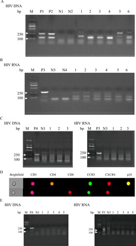 Figure 5. Co-culture of HIV nucleic acid detected in purified spermatozoa from HIV-infected men with PBMCs of healthy men. Purified spermatozoa from the TN group co-cultured with CD8-deleted PBMCs from healthy men. (A) HIV DNA detected from co-cultured cells and (B) HIV RNA extracted from the co-culture supernatant reverse transcribed into cDNA and used for nested PCR. (C) HIV DNA and RNA extracted from spermatozoa of three untreated HIV-infected men and cultured alone. (D) HIV-infected CD4+ T co-cultured with purified spermatozoon from untreated HIV infections. (E) HIV DNA and RNA extracted from purified spermatozoon of HIV-infections under ART co-cultured with CD8-deleted PBMCs of healthy men. Positive results valued as one of the 122 base pair and 264 base pair target bands positive; negative result was valued otherwise. M, DNA marker; P1, P2 and P4, DNA extracted from PBMCs of untreated HIV-infected men as positive controls; P3, HIV RNA extracted from the plasma of untreated HIV-infected men as positive controls. N1–N2, DNA extracted from PBMCs of healthy men as negative controls; N3–N4, HIV RNA extracted from plasma of healthy men as negative controls. Figure A: 1, 3, 5, HIV DNA extracted from co-cultured PBMCs of healthy men with purified spermatozoa of HIV infections; 2, 4, 6, HIV DNA extracted from co-cultured CD8-deleted-PBMCs of healthy men with purified spermatozoa of HIV infections. Figure B: 1–6, HIV RNA extracted from the co-cultured supernatant reverse transcribed into cDNA used for nested PCR (1-6 consistent with the order in Figure A). Figure C: 1–3, HIV DNA and RNA extracted from purified spermatozoon from untreated HIV infections cultured alone. Figure E: 1–5, HIV DNA and RNA extracted from purified spermatozoon from HIV infections under ART co-cultured with CD8-deleted-PBMCs of healthy men.