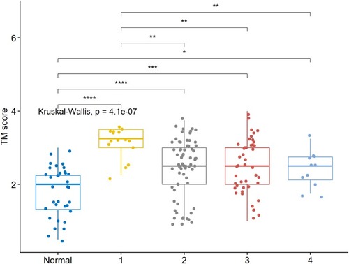 Figure 6 TM immunoexpression scores were significantly lower in normal bladder tissue. TM immunoexpression scores in bladder cancer tissue decreased across stage (*p ≤ 0.05, **p≤0.01,***p≤0.001,****p ≤ 0.0001).