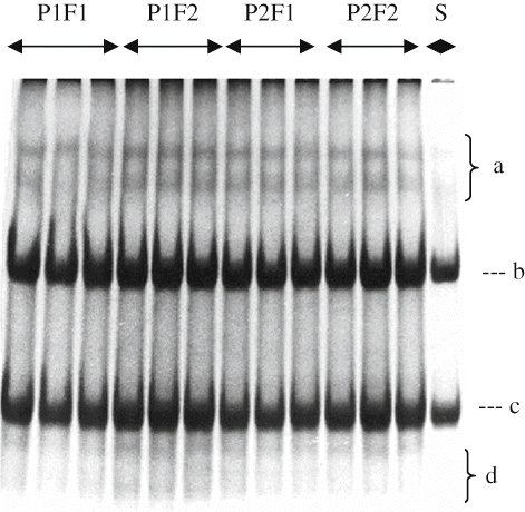 Figure 4 Urea-PAGE profiles of Herby cheeses for 150 days.