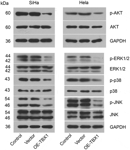 Figure 4. TBX1 inactivated AKT and MAPK signal pathways in CC cells. Western blot was used to evaluate the phosphorylation of proteins related to AKT and MAPK signal pathways in SiHa and Hela cells after transfection with OE-TBX1 plasmids or empty vectors