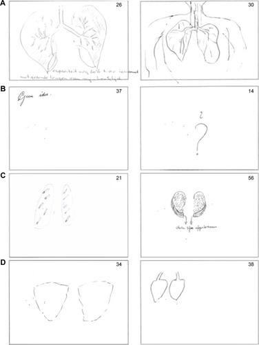 Figure 1 Examples of patients’ drawings.