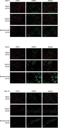 Figure 1 Quantum-dot double-labeling immunofluorescence assessment of CD31 and αSMA after treatment (400×).Notes: Five to six mice from three treatment groups (n=40) — epigallocatechin-3-gallate (EGCG), bevacizumab (positive control), and saline (blank control) — were euthanized on day 0, 2, 4, 6, 9, or 12, and then quantum-dot double-labeling immunofluorescence assessment was performed. Red staining denotes CD31 labeling vascular endothelial cells, representing disorders such as hypertrophy, lumen disfigurement, and discontinuity of connection (yellow arrow); formed and thickened lumen and continuous connection (orange arrow); and decrease in the number of lumina, along with thinning and discontinuous change in the wall (white arrow). Green staining denotes αSMA that labels vascular pericytes, which represent discontinuous connection (purple arrow) and a thickened, complete, and continuous state (pink arrow). When two fluorescently labeled images are merged, the coverage of vascular endothelial cells in pericytes can be observed to be incomplete, loosely interconnected or even completely absent (blue arrow). We can also see that the entire continuous layer of pericytes is covered with a complete and continuous layer of vascular endothelial cells, which are closely connected to each other (yellow arrows).