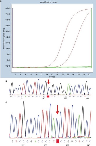 Figure 1 Illustration of polymerase chain reaction data on mutations of BRAFV600E and TERT promoters.Notes: (A) Amplification plot of PTC with BRAFV600E mutation. (B) TERT promoter C228T mutation identified in a case of PTC. (C) TERT promoter C250T mutation identified in a case of PTC.Abbreviation: PTC, papillary thyroid carcinoma.