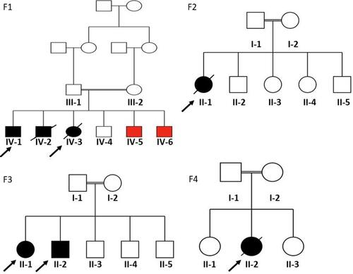 Figure 1 Pedigrees of the four participating families. F1 refers to family #1; F2, family #2; F3, family #3, and F4 refers to family #4. Squares and circles indicate male and female members, respectively. Black filled symbols represent affected individuals of relevance in this study, red filled symbols represent affected siblings with different disease, empty symbols for unaffected individuals, crossed symbols for deceased individuals, double lines represent consanguinity, and finally, arrows refer to probands in each case.