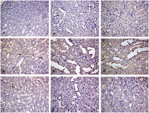 Figure 2. Immunohistochemical staining for phospho-p53 (×200) (A–C), Fas (D–F) (×400), and Fas-L (G–I) (×400). Control group (A, D, G), cisplatin group (B, E, H), cisplatin + curcumin group (C, F, I). Immunopositive cells (arrows).