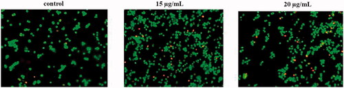 Figure 6. Apoptotic effect of gold nanoparticles synthesised from Strychni semen in KMCH-1 Cells.