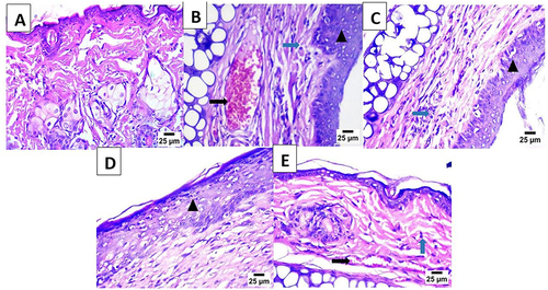Figure 15 (A) dorsal skin micrograph of healthy mice, (B) dorsal skin micrograph of mice receiving 5%IMQ only, (C) dorsal skin micrograph of mice receiving 5%IMQ and CsA-DTH solution, (D) dorsal skin micrograph of mice receiving 5%IMQ and commercial Betnovate Ointment and (E) dorsal skin micrograph of mice receiving 5%IMQ and CsA-DTH loaded Cerosomes.