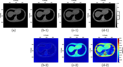 Figure 7. Performance comparison of three algorithms at photon energy 80 keV; (a) is the reference image of μ(r,80). (b-1), (c-1) and (d-1) are reconstructed images by the iterative method, the first-order method and the second-order method, respectively. (b-2), (c-2) and (d-2) are difference images of (b-1), (c-1) and (d-1) from (a), respectively.