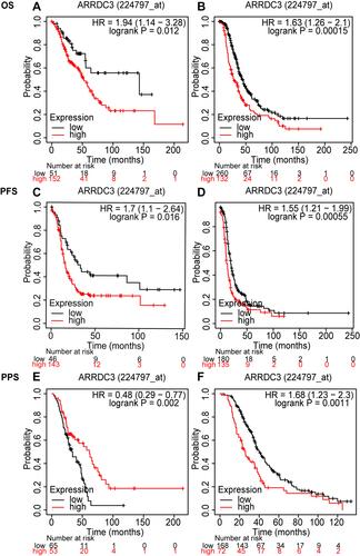 Figure 4 Stratified survival analysis of ARRDC3 in ovarian cancer by pathological grade of OS, PFS, PPS. (A and B) Stratified survival analysis of ARRDC3 in ovarian cancer of low grade and high grade of OS, respectively; (C and D) stratified survival analysis of ARRDC3 in ovarian cancer of low grade and high grade of PFS, respectively; (E and F) stratified survival analysis of ARRDC3 in ovarian cancer of low grade and high grade of PPS, respectively.