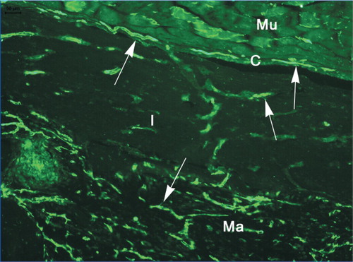 Figure 4. Vascularity in and adjacent to DXBM implant in male WT mouse as shown by staining for platelet endothelial cell adhesion molecule‐1 (PECAM‐1/CD31). Mu: muscle; C: capsule; I: implant; and Ma: marrow. Arrows indicate blood vessels.