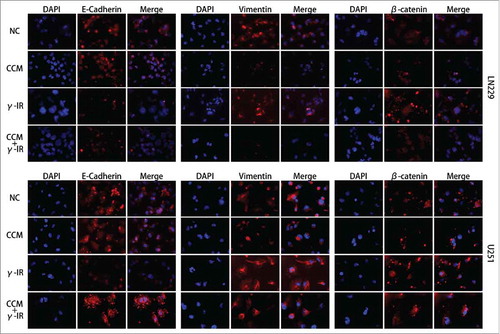 Figure 4. The Immunofluorescence assay showed that the induction of EMT was rescued by Curcumin. Nucleus were stained with DAPI (blue), while E-cadherin, Vimentin and β-catenin were shown in red. The merged pictures were combining with DAPI and the target proteins. γ-IR group showed the induction of EMT in both LN229 and U251, however the CCM+γ-IR group had restrained the process of EMT. All images were taken microscopically (40 ×).