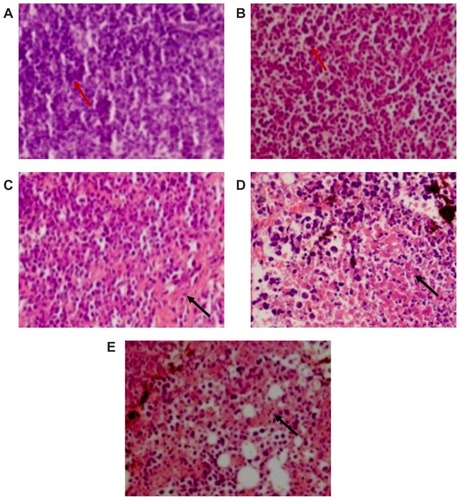 Figure 5 Histopathologic examinations of K562/A02 tumors at day 12 after treatment (hematoxylin-eosin staining, 400×). (A) control, (B) DNR, (C) DNR and 5-BrTet, (D) Fe3O4-MNP, and (E) Fe3O4-MNP-DNR-5-BrTet.Abbreviations: DNR, daunorubicin; 5-BrTet, 5-bromotetrandrine; Fe3O4,-MNP, magnetic nanoparticles of Fe3O4.
