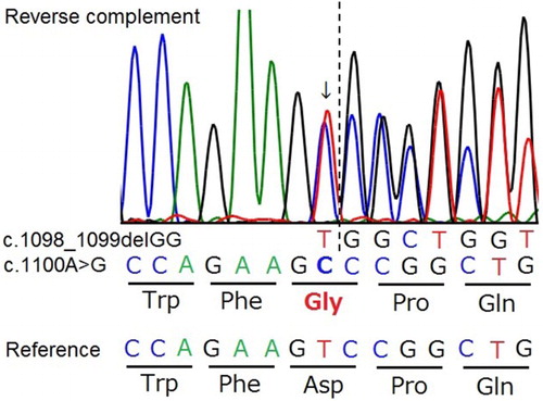 Figure 5. Genomic DNA sequencing chromatograms of a small region surrounding the known two-base deletion in NAGLU gene (c.1098_1099delGG) in a heterozygous bird also having a missense polymorphism (c.1100A > G). A single nucleotide substitution (arrow) adjacent to the known mutation site (dotted line) is predicted to change the amino acid from aspartic acid (Asp, D) to glycine (Gly, G).